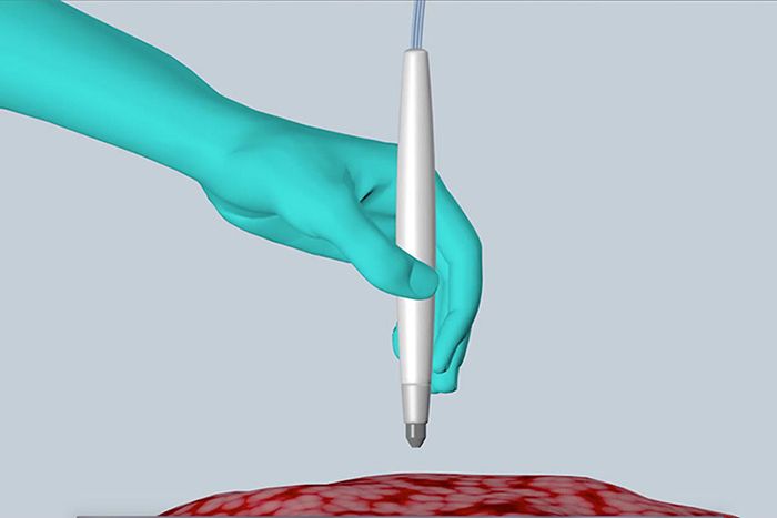 The MasSpec Pen