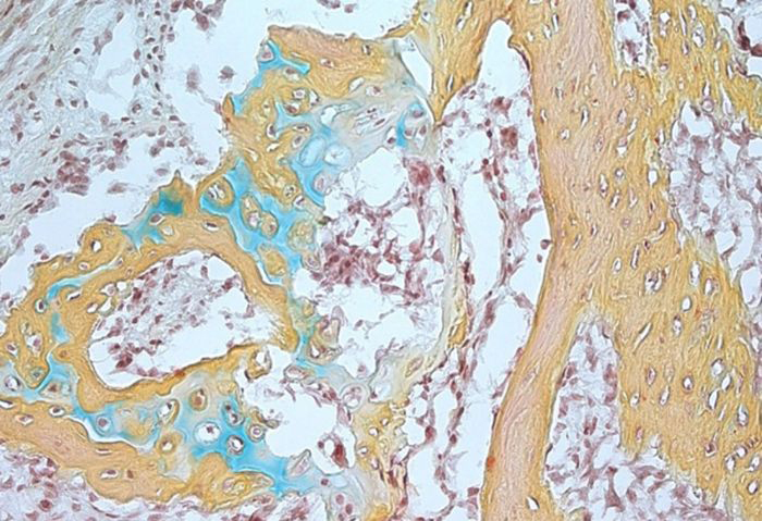 A small bone structure arising from the human skeletal stem cell contains cartilage, bone marrow and bone.