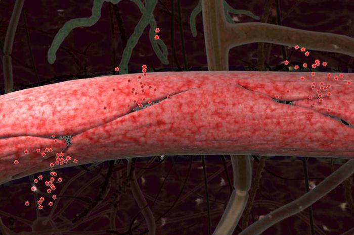 Image depicts a blood vessel in the brain that has become leaky, or permeable.