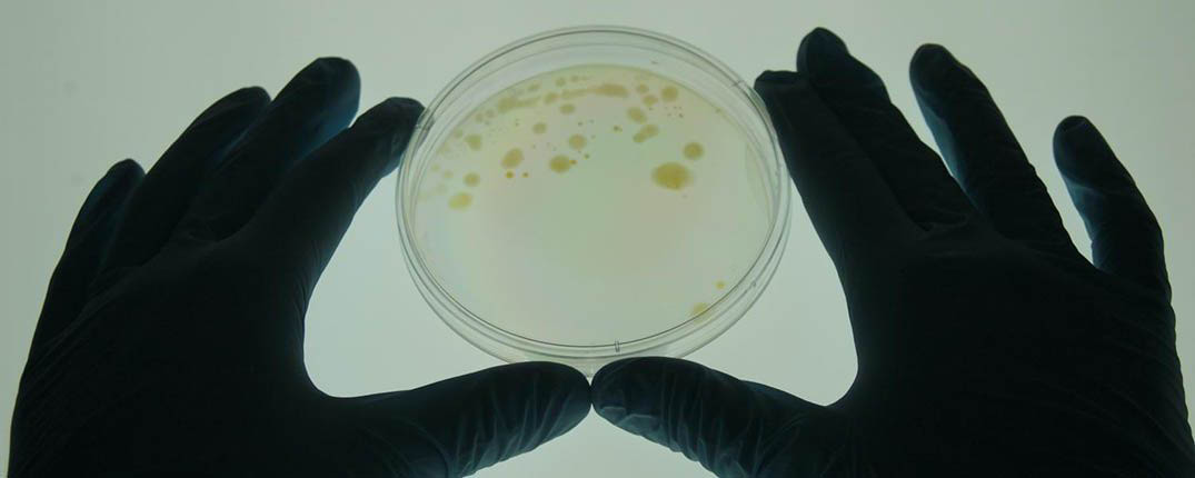 A researcher examines a sample of Mycobacterium vaccae.