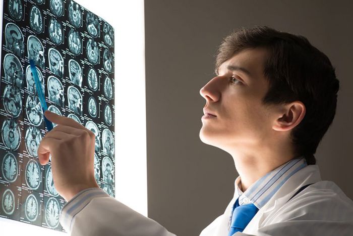 Resident reviewing brain scan