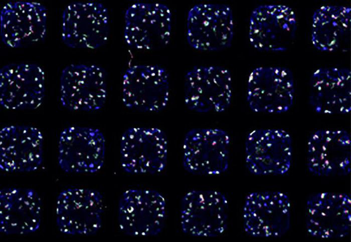 kidney organoids
