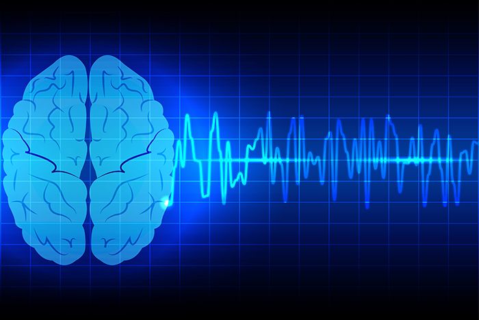 Brain image