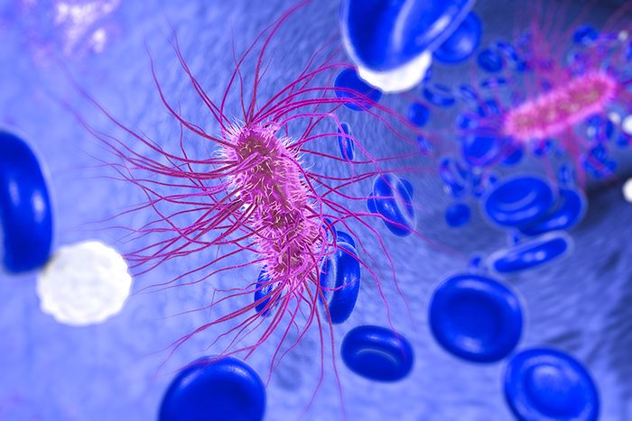 Sepsis