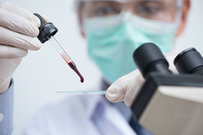 Lab technician drops blood on a slide.
