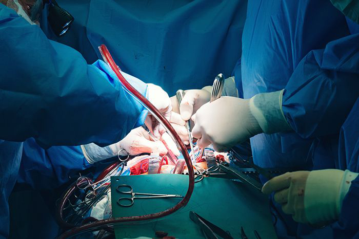 Image of surgeons performing heart surgery