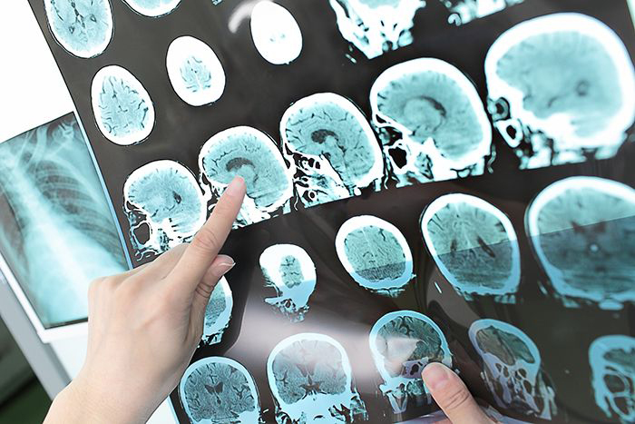 Doctor views a CT scan