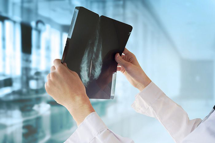 Doctor studies a mamography