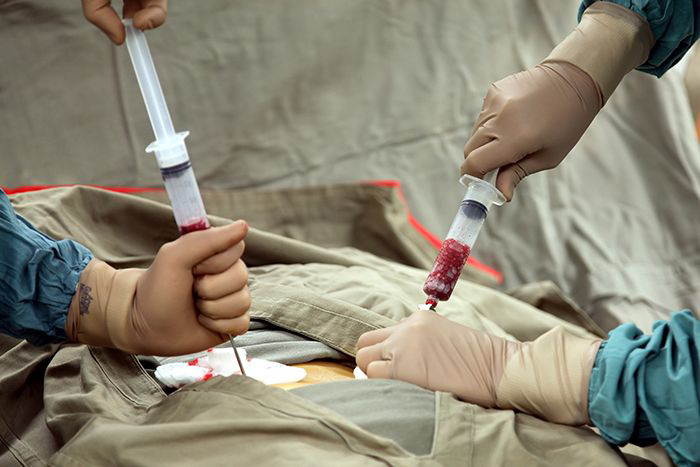 Image of doctors harvesting bone marrow
