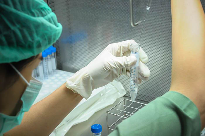 Sperm preparation testing in infertility lab