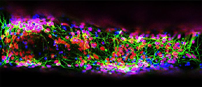 staining_hi_res-700x302-compressor.jpg