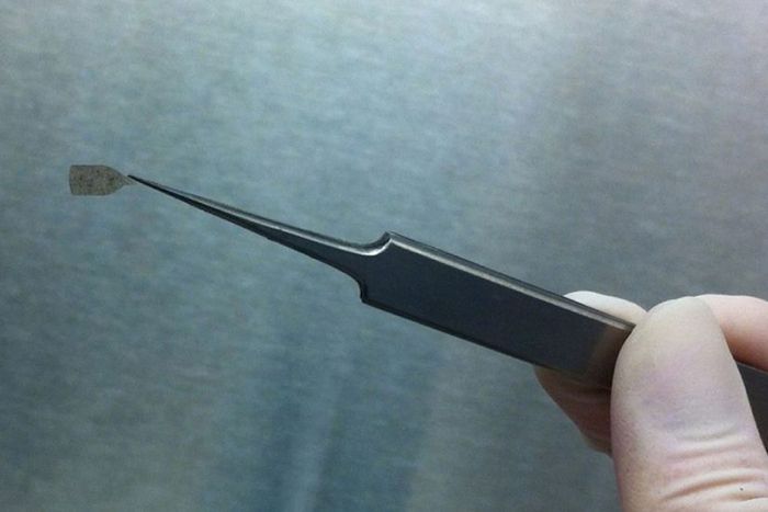 stem cell-based retinal implant
