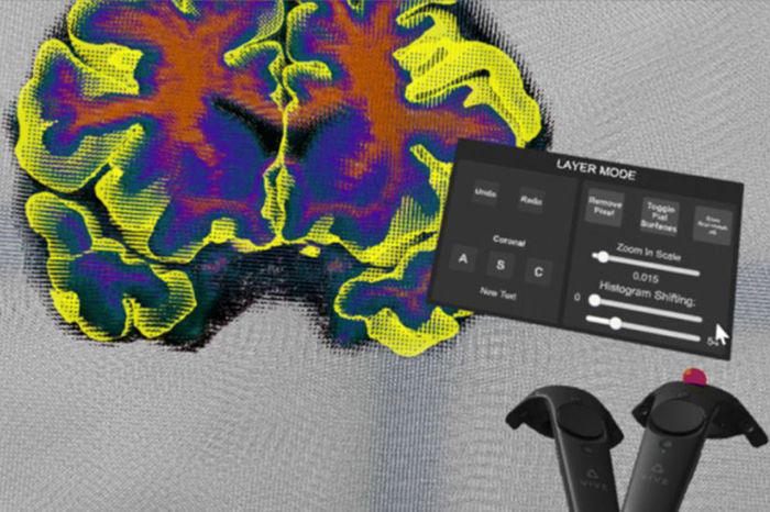 The Virtual Brain Segmenter