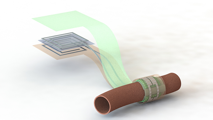 Artist’s depiction of the biodegradable pressure sensor wrapped around a blood vessel with the antenna off to the side.