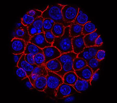 A pancreatic cancer cell.