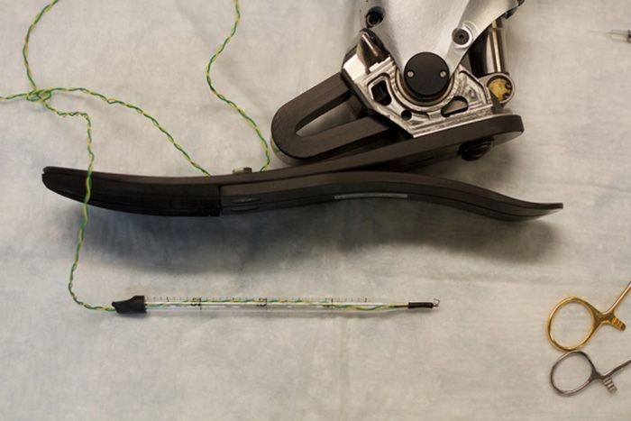 Photo of prosthetic limb