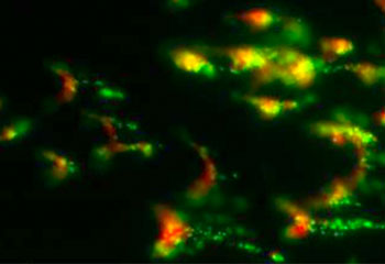 "Biomedical engineer explores new use for synthetic platelets: treating inherited bleeding disorders"