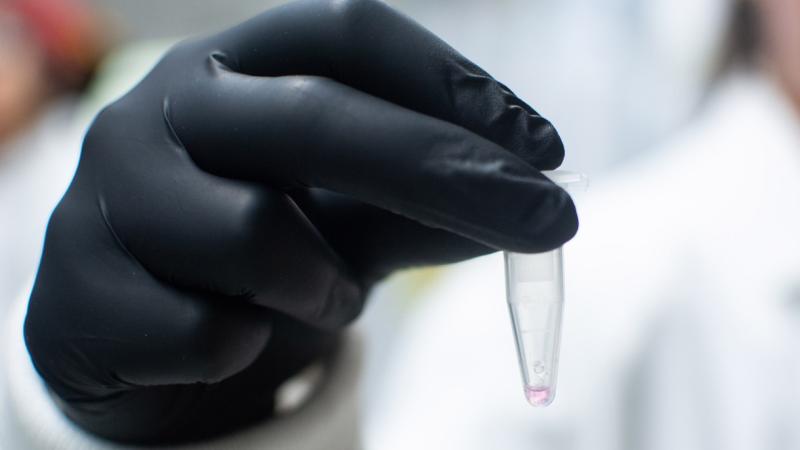 "Brown senior Emma Rothkopf shows what a 20 microfilter sample looks like."