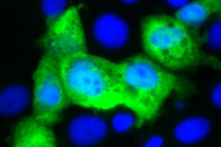 New Approach Targets Norovirus, World’s Leading Cause of Foodborne Infection; Intestinal cells (nuclei shown in blue) are infected with a strain of rotavirus genetically modified to carry a gene from norovirus (green).