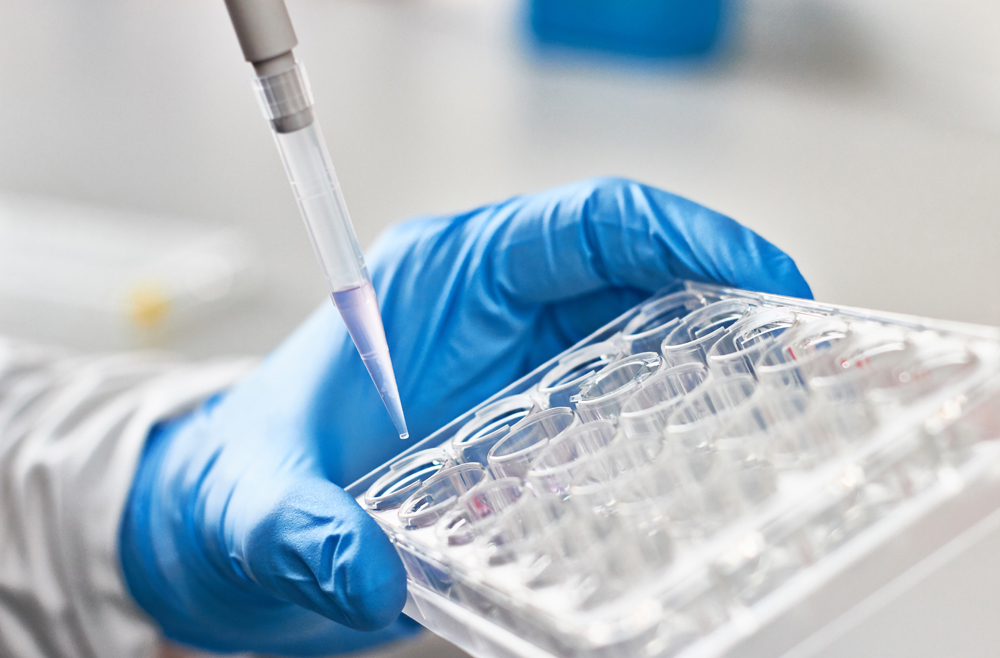 Biological Test Detects Parkinson’s Disease Before Symptoms Present; Photo of scientist piping liquid into test tubes