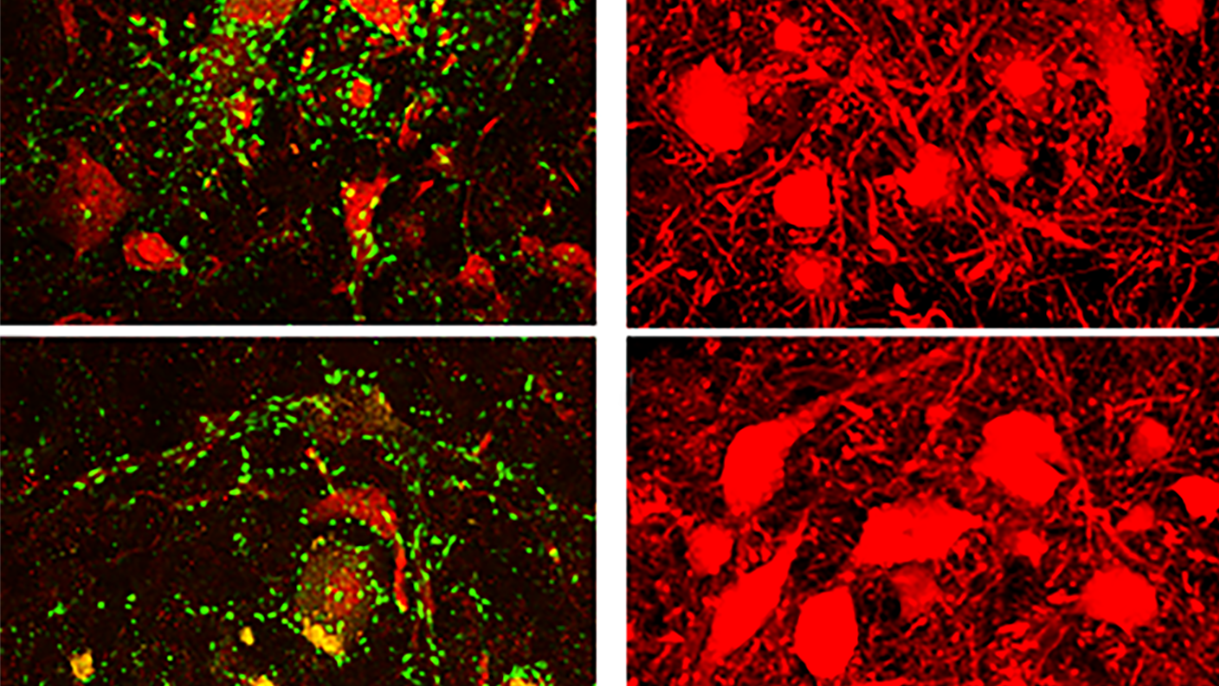 Old Motor Neurons Don’t Die, Scientists Discover, They Just Slow Down; These images, adapted from the research paper, show that motor neurons in the spinal cord of an aged mouse (bottom) have fewer synaptic inputs than those in younger adults (top).