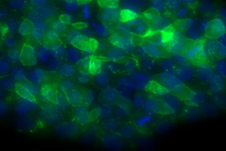 Possible Treatment Strategy Identified for Bone Marrow Failure Syndrome; Shown are human embryonic stem cells engineered to have a mutation that causes poikiloderma with neutropenia, a bone marrow failure syndrome that increases a patient's risk of developing dangerous infections. (Image: Batista Lab/School of Medicine)