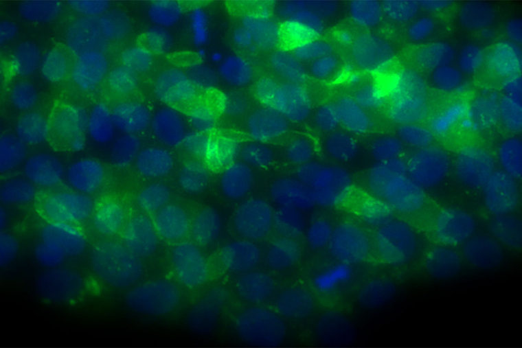 "Possible Treatment Strategy Identified for Bone Marrow Failure Syndrome; Shown are human embryonic stem cells engineered to have a mutation that causes bone marrow failure syndrome"