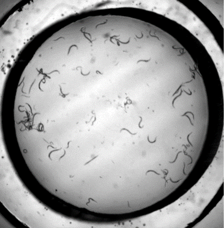 "New ‘gym-on-a-chip’ for worms may lead to new Parkinson’s treatments; C. elegans worms seen under a microscope swimming inside an "Acoustic Gym." (Credit: Xiaoyun Ding)"