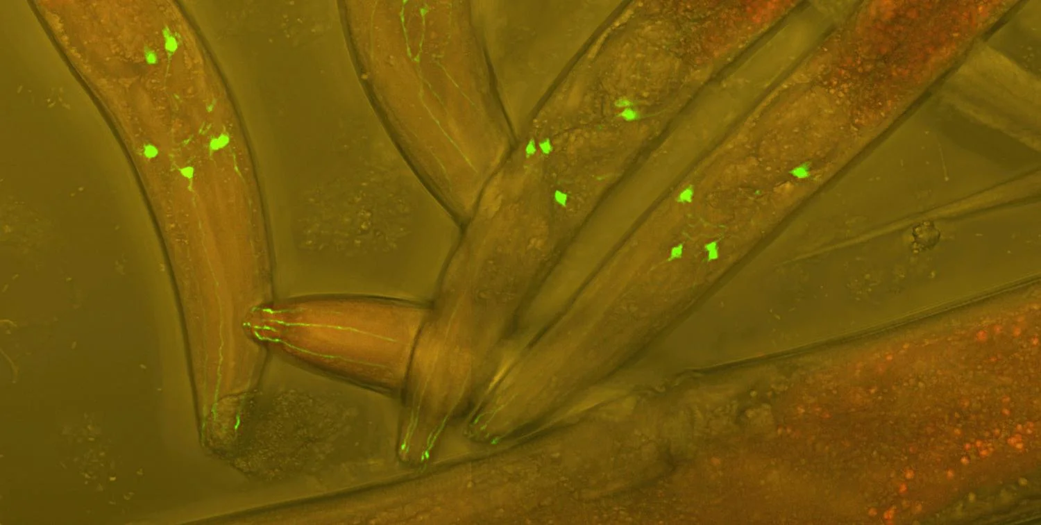 New ‘gym-on-a-chip’ for worms may lead to new Parkinson’s treatments; C. elegans worms seen under the microscope dyed with fluorescent proteins. (Credit: CC photo via Wikimedia Commons)