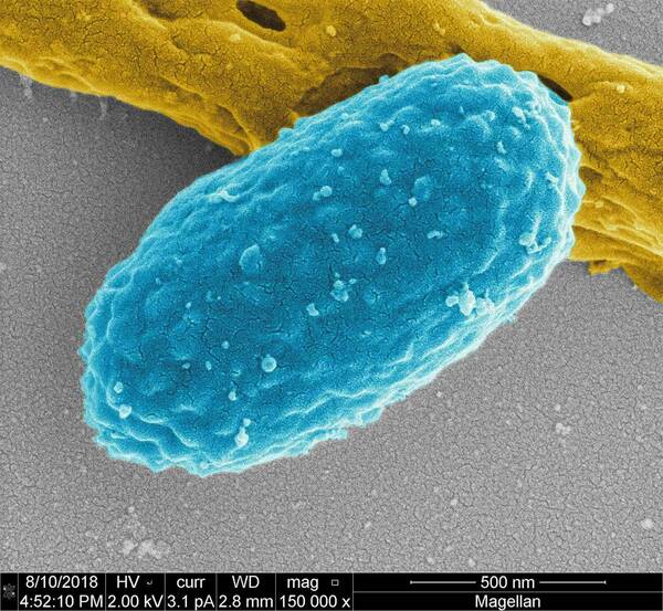 Potential Requiem for a Bacterium: Notre Dame Biochemists Discover Antibiotic That Fights C. Diff Infection