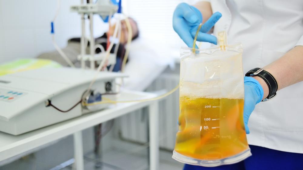 "Study provides roadmap for using convalescent plasma as an effective COVID-19 treatment; photo of covalescent plasma in medical bag"
