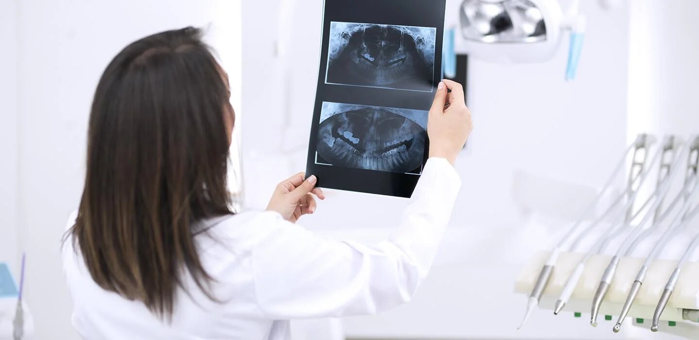 A Pitt study linked some cancers to dental disease; Doctor examining an x-ray
