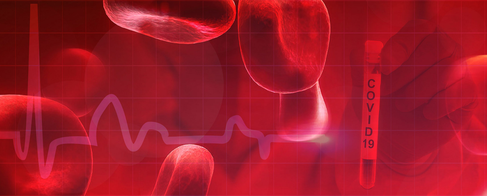 Bloodstream Infection