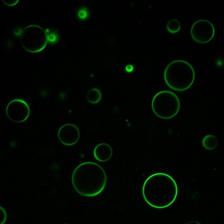 vesicles