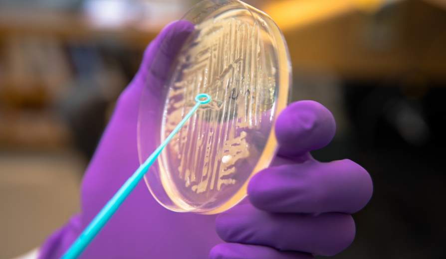 bacteria on a petri dish 