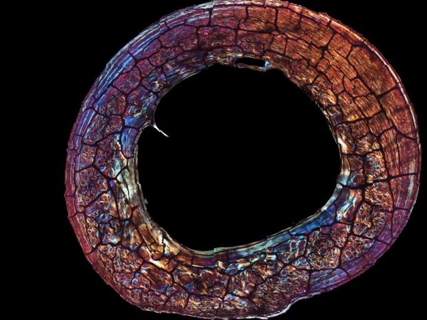 A microscopic image of the mid-shaft section of a primate femur