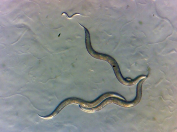 Worms collected in the Chornobyl Exclusion Zone, as seen under a microscope.