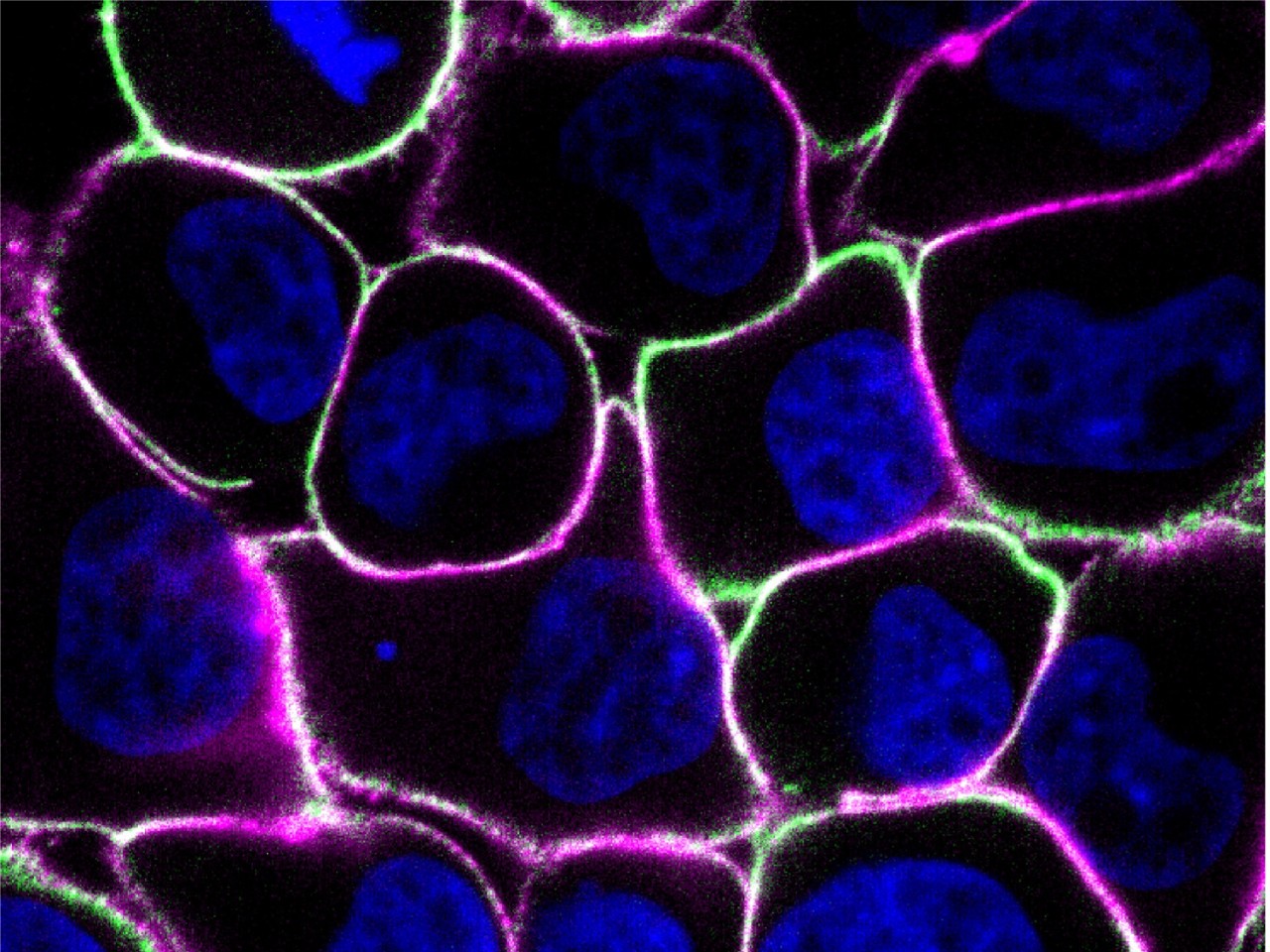 Cancer cells
