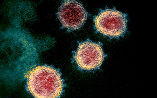 Electron micrograph