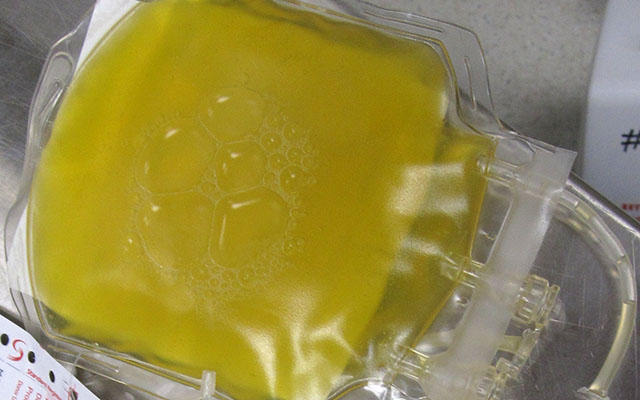 Plasma