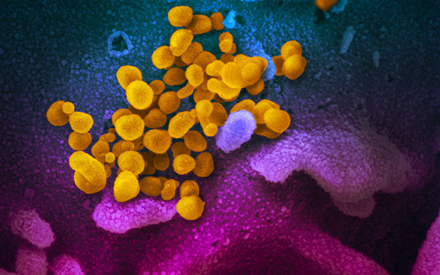 Colorized scanning electron micrograph of SARS-CoV-2 coronavirus