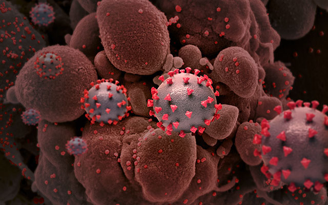 Creative rendition of SARS-CoV-2 particles