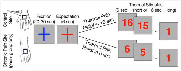 Diagram of neuropathic pain in HIV