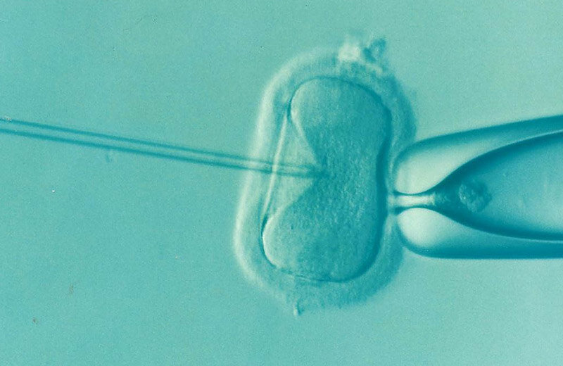 in vitro fertilization