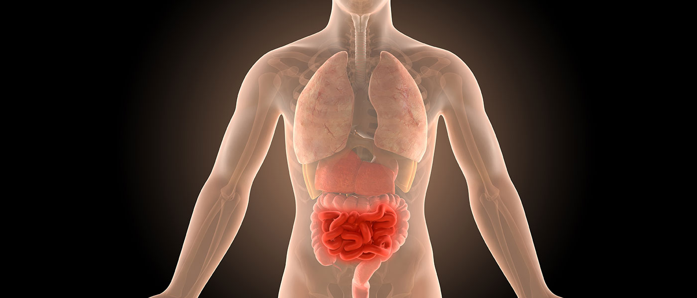 Depiction of Chrohns disease