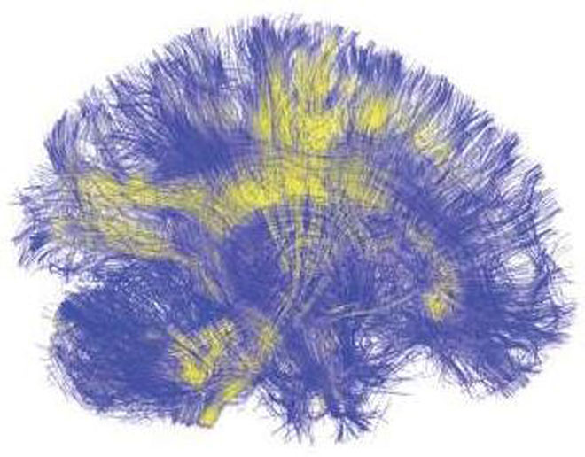 Image of brain