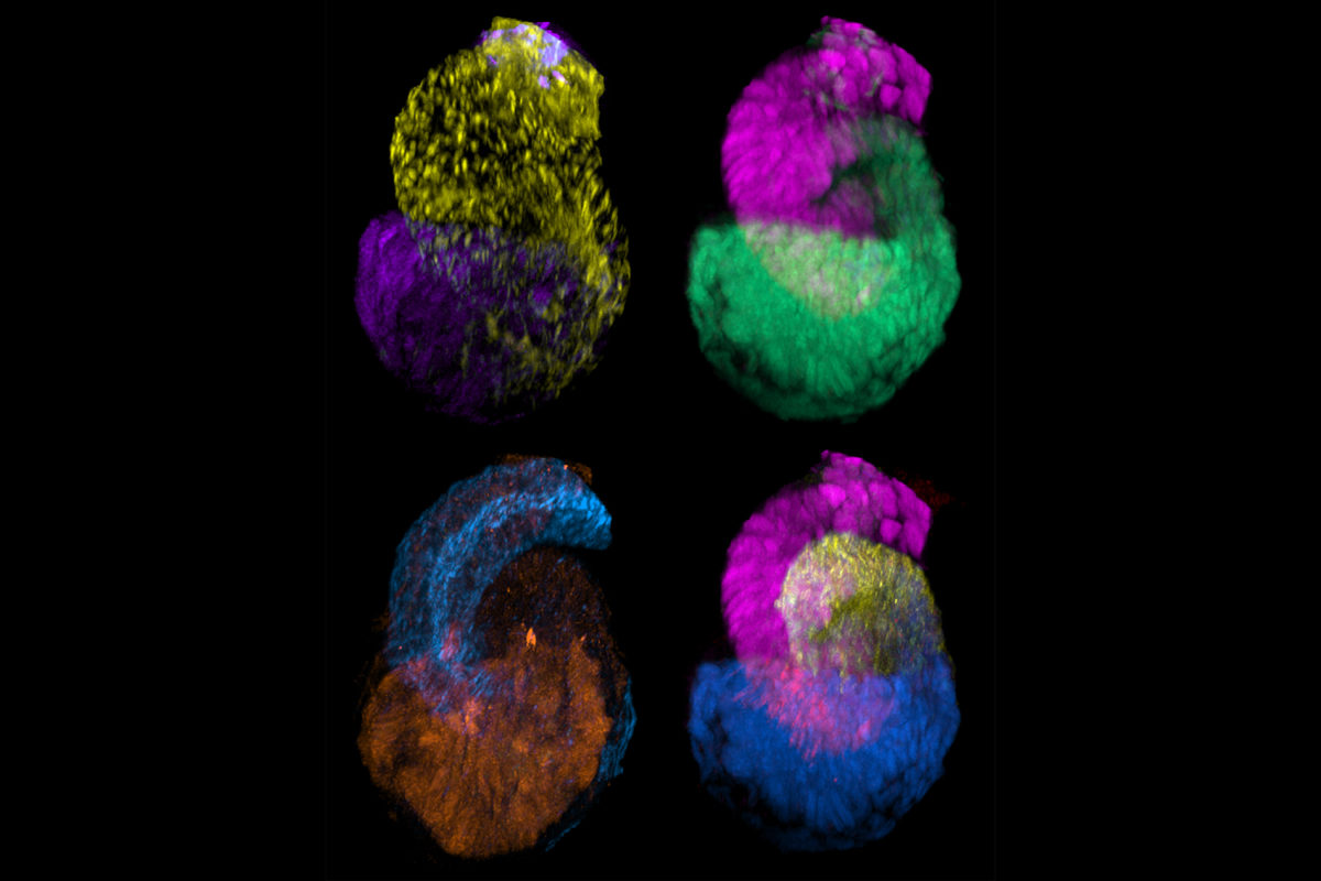 Nephrons, also known as the kidney's filtering units