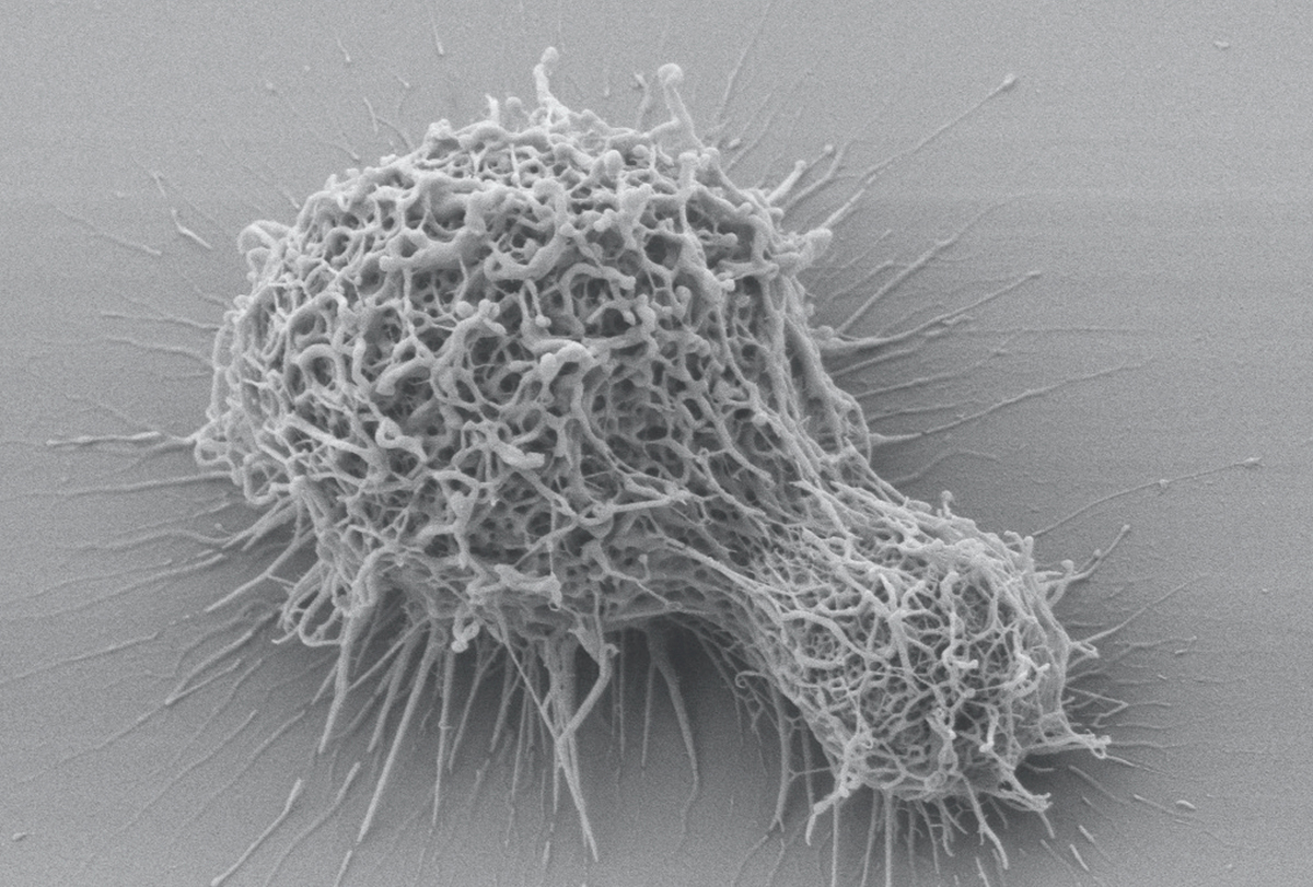 A scanned electron microscopy of a cell of Cryptococcus neoformans showing the “hairs” within the fungal cell that cause disease