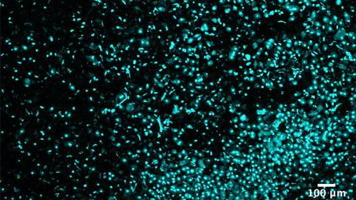 cancer researchers analyze and sequence individual cells from complex tissues such as tumors