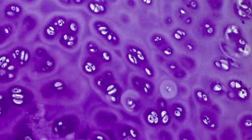 chondrocytes